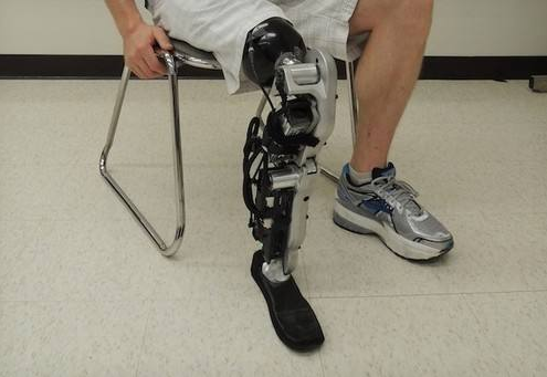 淺談膝關(guān)節(jié)對大腿截肢具有哪些重要性(圖1) 淺談膝關(guān)節(jié)對大腿截肢具有哪些重要性(圖1)