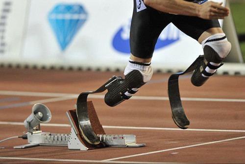 安裝假肢后走路出現步幅不均的原因有哪些(圖1) 安裝假肢后走路出現步幅不均的原因有哪些(圖1)