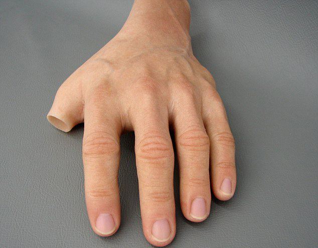 手部假肢價格多少錢以及假肢有哪些類型(圖1) 手部假肢價格多少錢以及假肢有哪些類型(圖1)